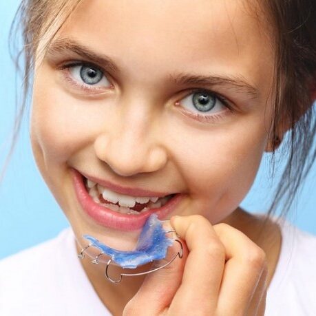 Niña sonriendo con aparato removible azul de ortopedia maxilar infantil