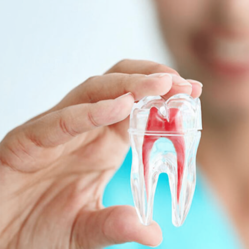 imagen endodoncia