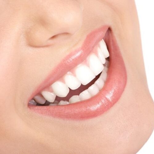 Sonrisa blanca y perfecta mostrando resultados de estética dental y diseño de sonrisa