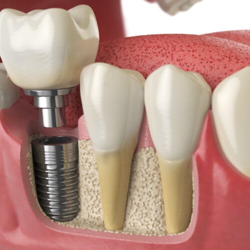 imagen periodoncia