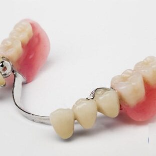 imagen rehabilitacion oral